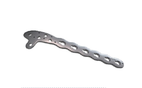 TM Bauer’s Synthes Пластина дистальна-латеральна плечова